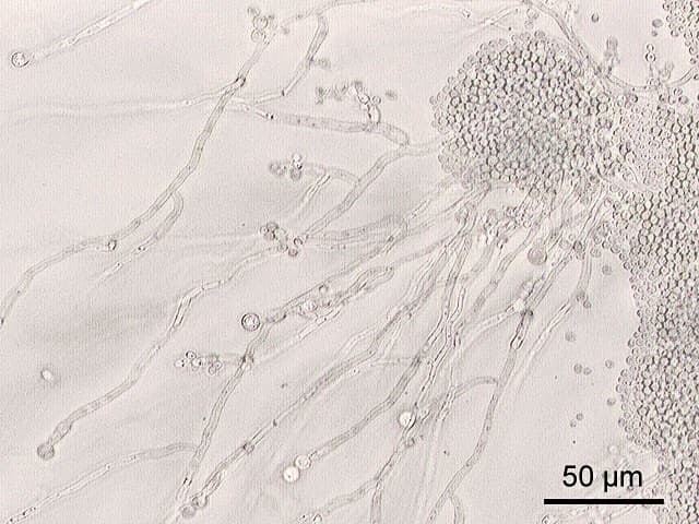 Candida albicans is a fungus that often lives in our gut. It generally exists as single cells but may grow as filaments. It's usually harmless but sometimes causes disease.