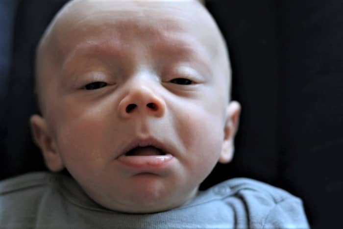 Coughs and sneezes can spread diseases. This photo of a baby who is about to sneeze was taken at just the right moment.