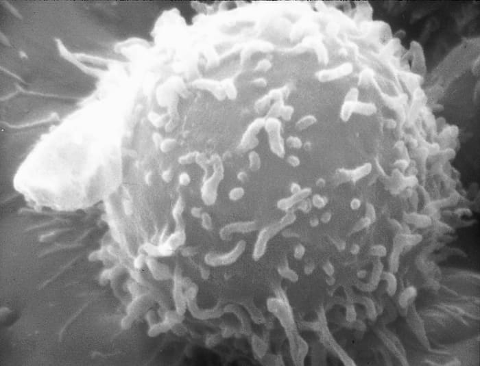A human lymphocyte; B and T lymphocytes are difficult to distinguish visually