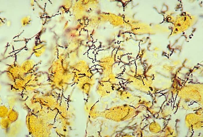 Treponema pallidum (unknown subspecies)