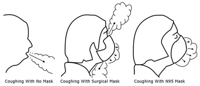 Figure 4. Side view of air leakage around face masks, adapted from Figure 5, Section d in Tang et. al. (2009).