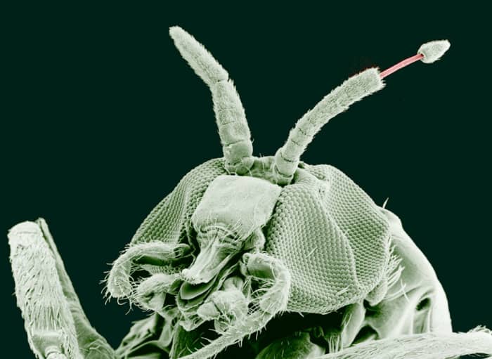 An adult black fly with the nematode that causes river blindness emerging from an antenna (magnified 100 times)
