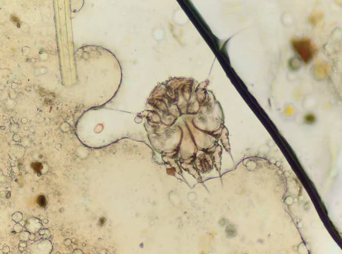 Micrograph of the microscopic human itch mite, or scabies mite (Sarcoptes scabiei hominis). These mites burrow into the skin causing intense itching.