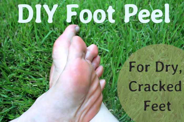 do-it-yourself-foot-peel