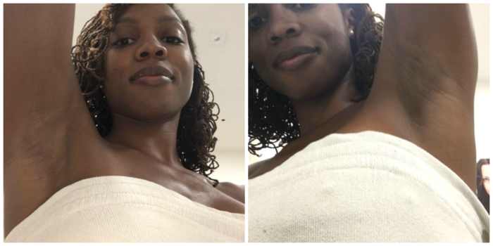 Before the procedure