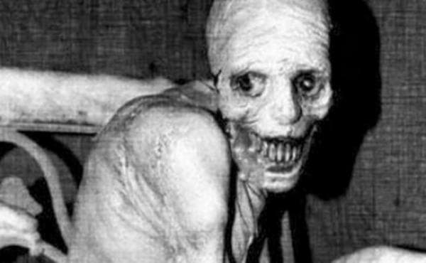An image now famously associated with the creepypasta "The Russian Sleep Experiment." Don't worry, it's just a Halloween decoration called Spazm.