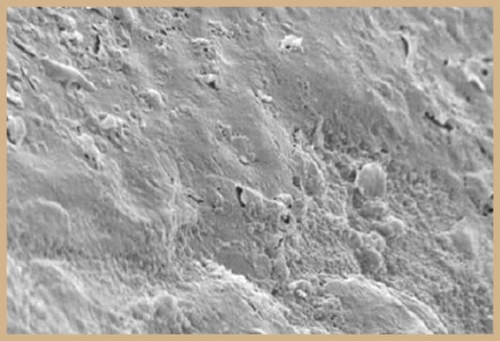 Under a microscope and magnified 5,000 times, this image shows plaque accumulation on the glazed side of the fitting surface of a denture after just one month!