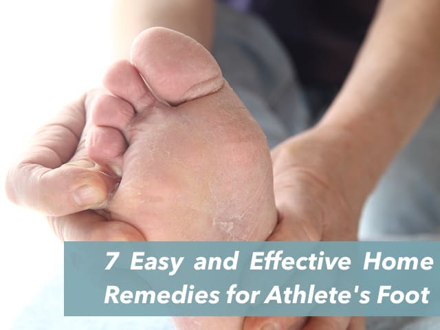 7-easy-and-effective-home-remedies-for-athlete-s-foot-remedygrove