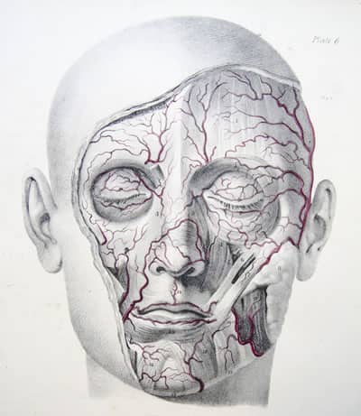 Arteritis typically occurs after age 50.