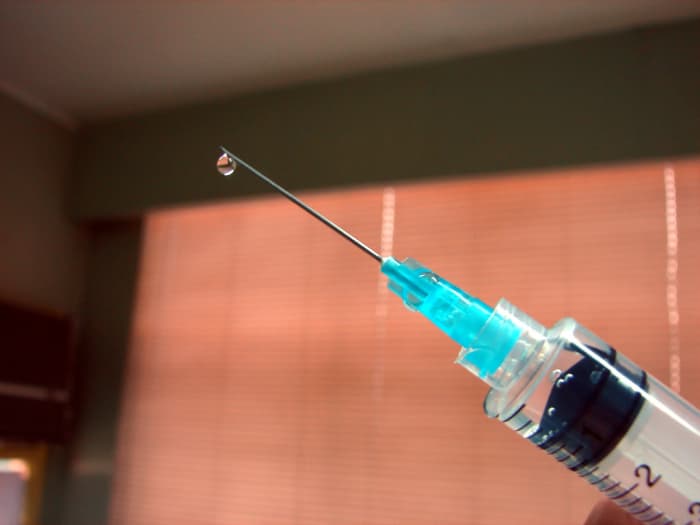 I received more than 20 injections into the corners of my eyes, upper eyelids, the areas beneath my eyes, above my brows, cheeks, and the sides of my nose. These were quite painful.