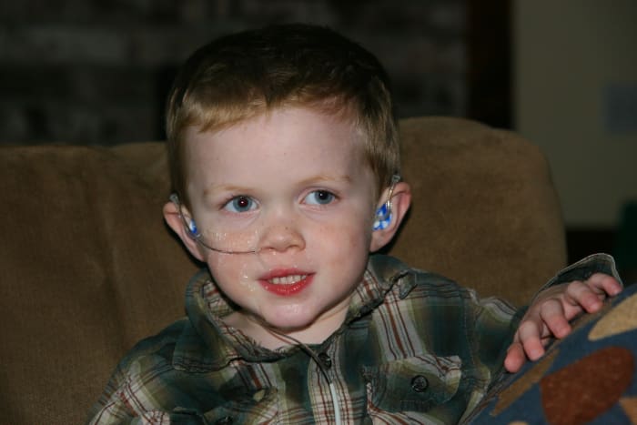 A pH probe may be performed if laryngomalacia is complicated by acid reflux. This involves a small pH-detecting probe inserted through the nose, which is worn for 24 hours.