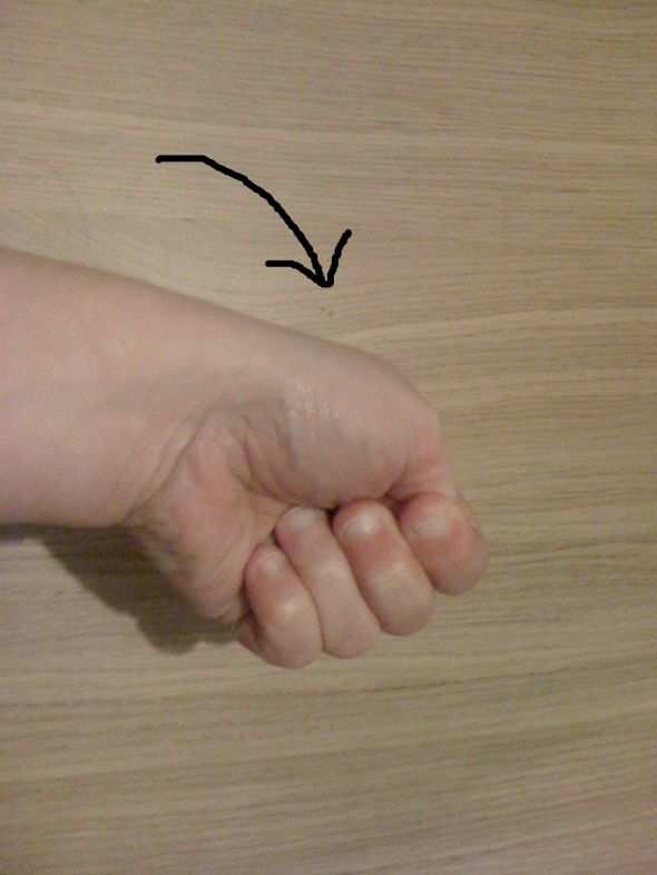 My Experience With Thumb and Wrist Pain (Includes Exercises) Patient