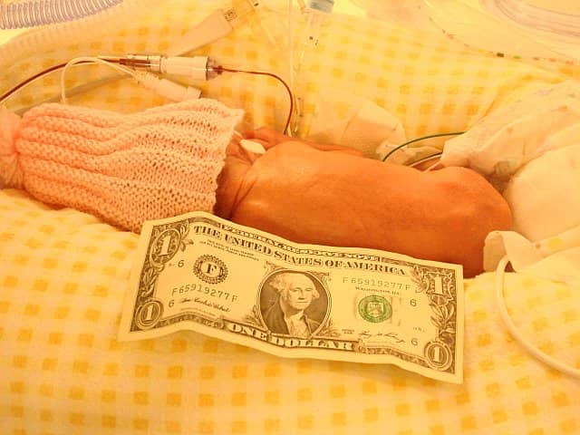 incubator baby incubator baby