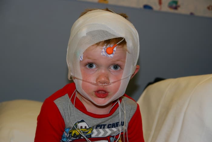 Pediatric Sleep Study: All hooked up and ready for bed. It might be hard to get to sleep with all of this equipment on!