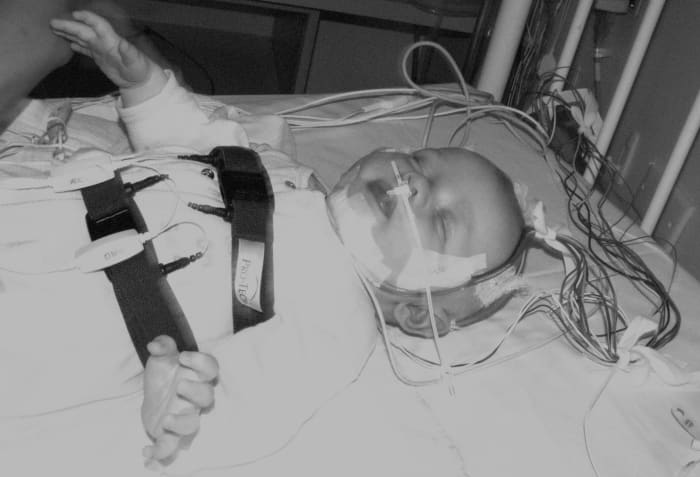 A three month old boy undergoes a sleep study test. Sleep studies are particularly stressful for nursing infants and their mothers.