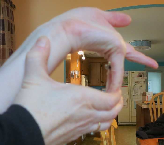 What Is EhlersDanlos Syndrome? My Story Patient's Lounge