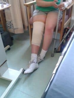 This is my leg right after my operation to get my pins removed. I was still at the hospital, waiting to be discharged.