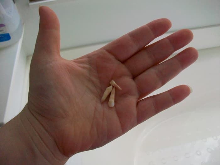 Look at the size of the roots on those canines! No wonder it hurts to get teeth pulled