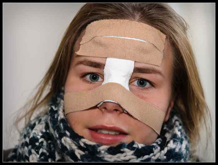 How To Tell If Your Child's Nose Is Broken Patient's Lounge