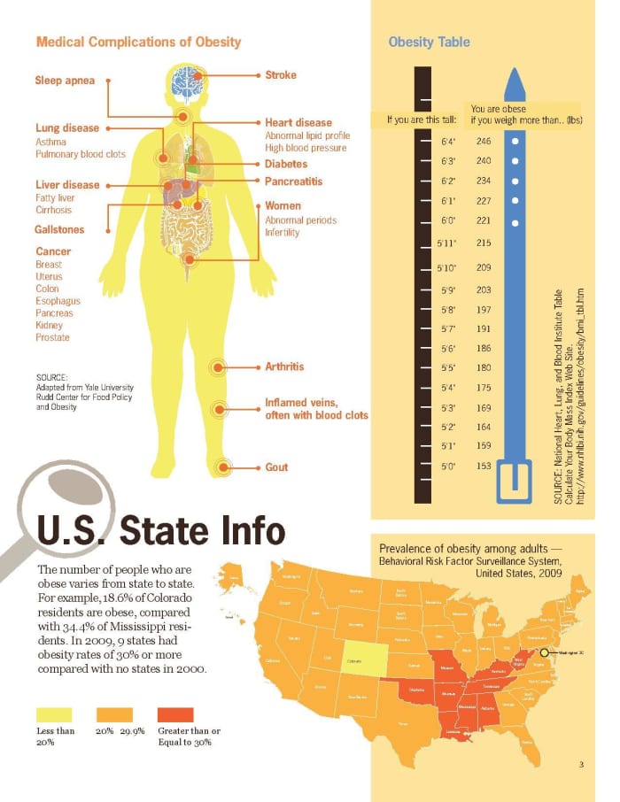 Illustration shows that obesity may contribute to sleep apnea