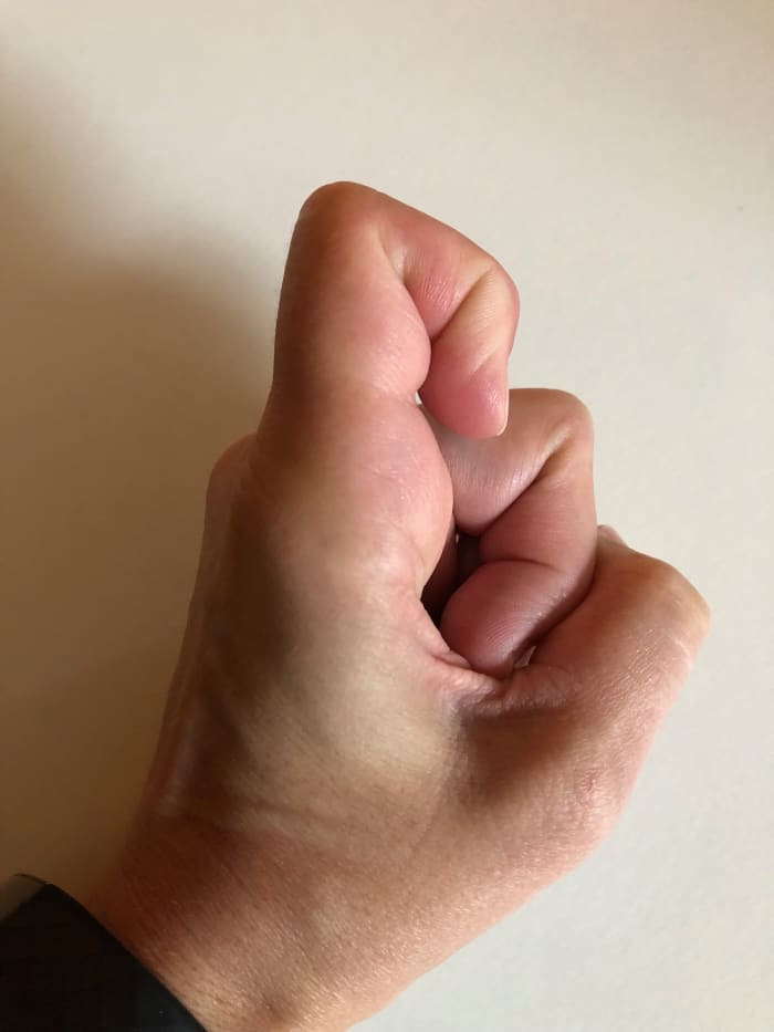 Start with your finger pointed up, then slowly bend the tip towards your knuckle. My doctor told me to do 10 repetitions daily.