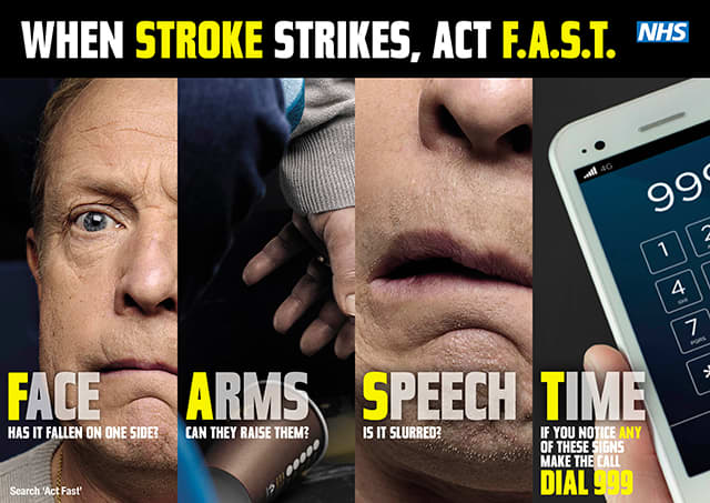 Here's what to look for if you suspect a stroke. Remember the acronym F.A.S.T. F: Facial drooping A: Arm weakness S: Speech difficulties T: Time to call emergency services