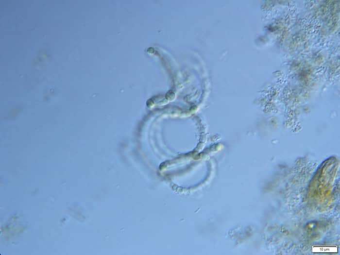 Cyanobacteria such as this Anabaena play an important role as photosynthesizers in microbial food webs