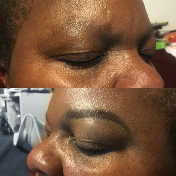 Before and after