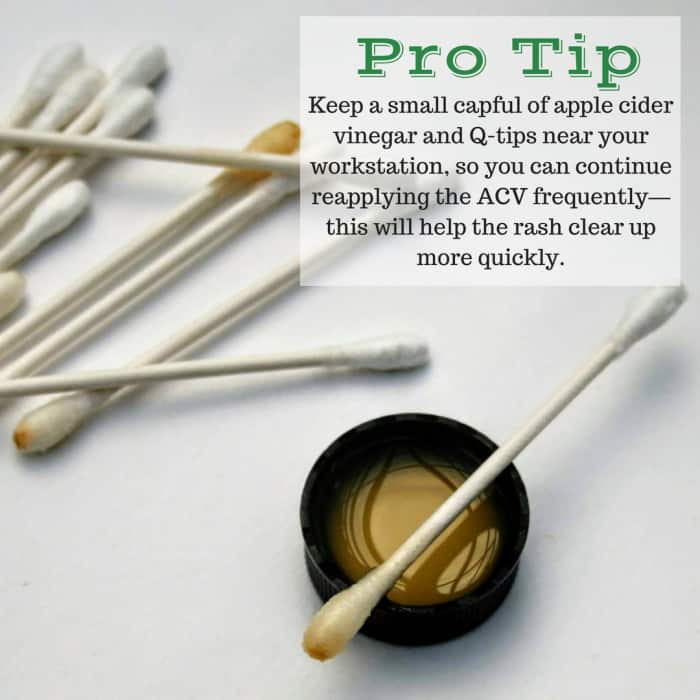 A Natural and Fast Poison Ivy Cure RemedyGrove