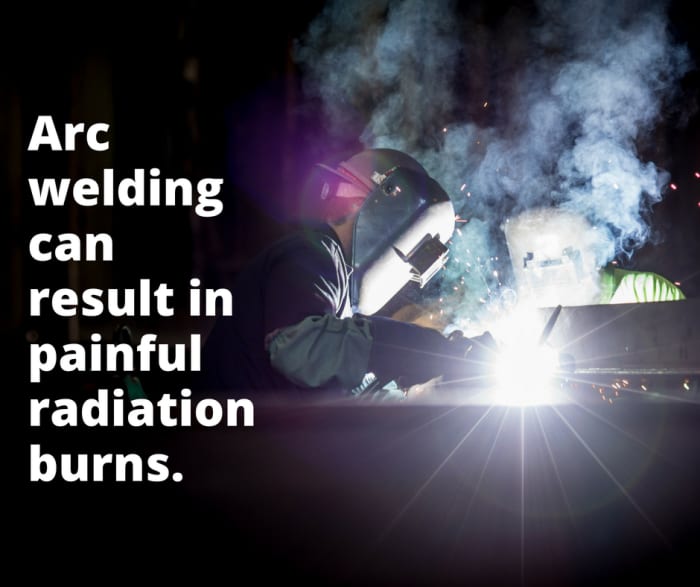 Most arc welders understand using a shield to protect the eyes but do not wear suitable gauntlets and flame-proof clothing to protect the arms and other exposed skin area from sparks and radiation.