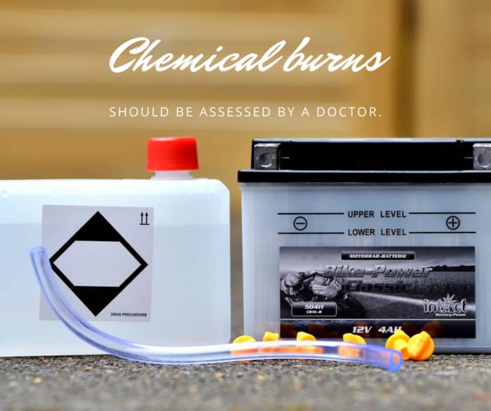 Remove any jewelry, watches, or clothing that has been contaminated with the chemical. Use a cool wet towel or cloth to help relieve pain.