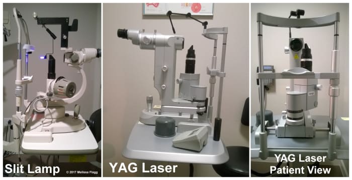 From left to right: A standard slit lamp, a YAG laser and a view of the YAG laser from where the patient sits