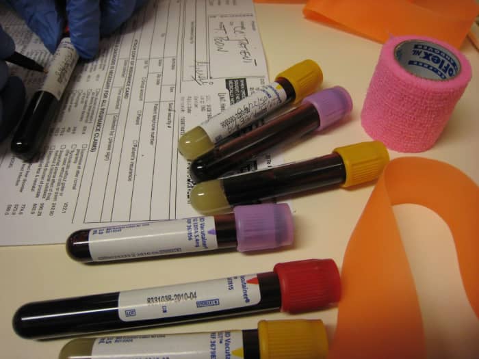 Googling symptoms can often yield misleading information, resulting in unnecessary suspicions and anxiety for patients awaiting test results.