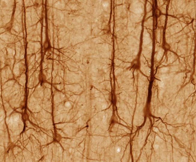 These are brain neurons. Notice all the space between them. It's all flesh mixed with water. The water is necessary to separate the dendrons a bit, so they're not always charging us to action. (Hmmm. Wonder if that's a cause of ADHD?)