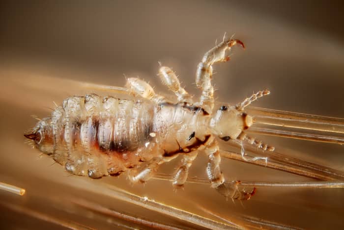 How to Prevent Lice in Your Home This School Year - WeHaveKids