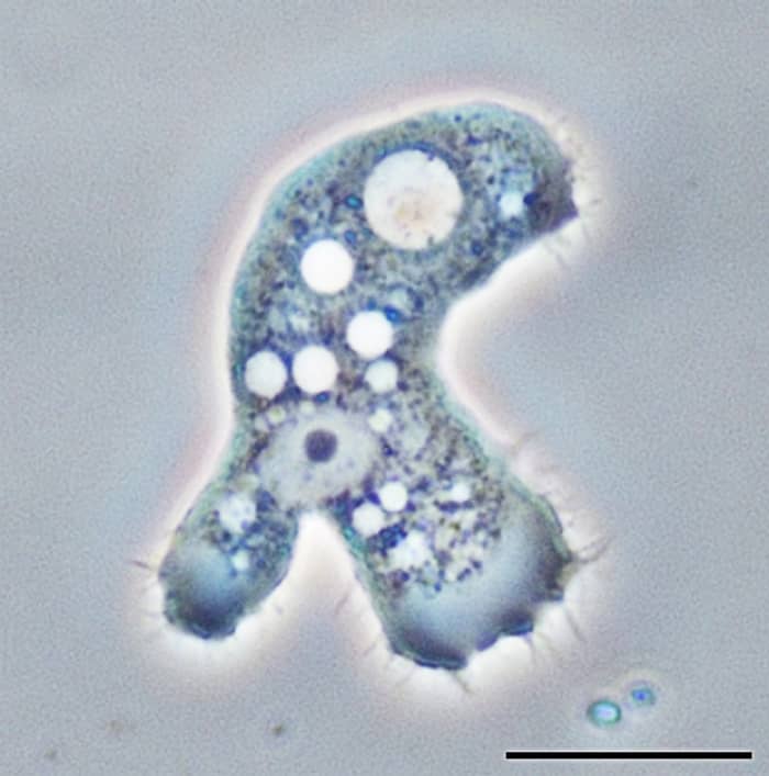 An Acanthamoeba trophozoite viewed under a phase contrast microscope