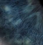 Close up of the iris fibers