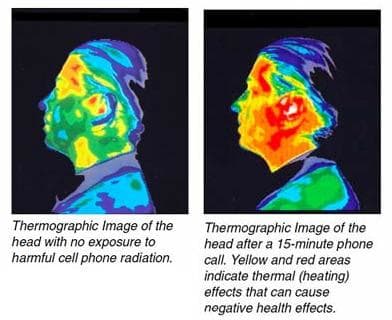 It is well know that a cell phone will cause nearby parts of the human body to heat up. This image graphically demonstrates the heating effect of a cell phone on a human head.