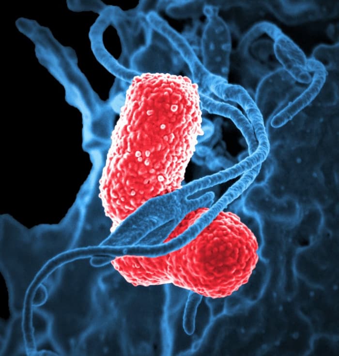 Multidrug-resistant Klebsiella pneumoniae (colorized scanning electron micrograph)