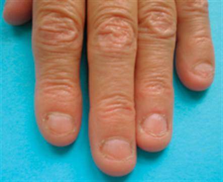 easy-steps-stop-biting-your-nails