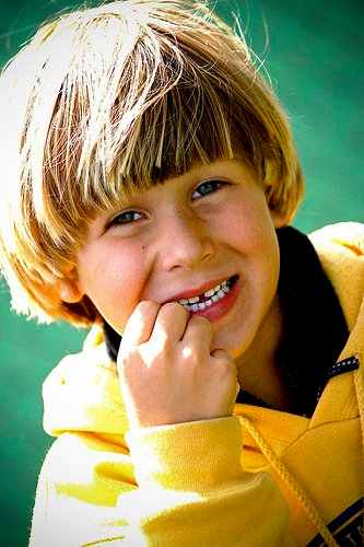 A boys' bowl haircut.