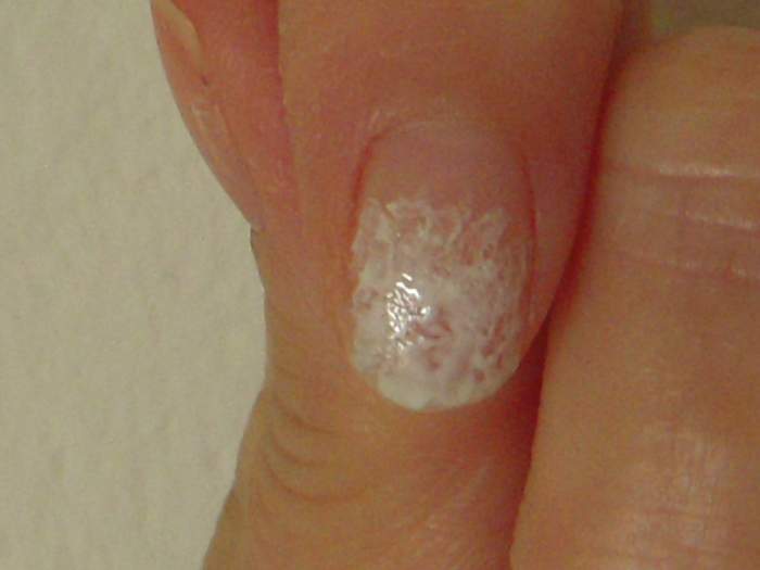 2 coats of polish stippled on nail.