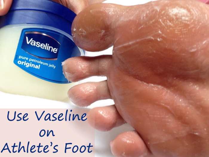 42 Amazing Uses for Vaseline Bellatory
