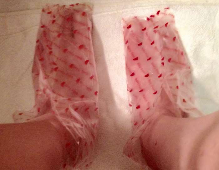 Baby Foot sock type treatment