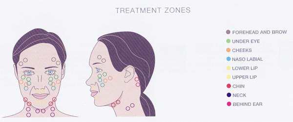 Facial Zones Diagram