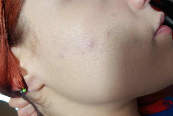 I expected better from 'full-coverage'