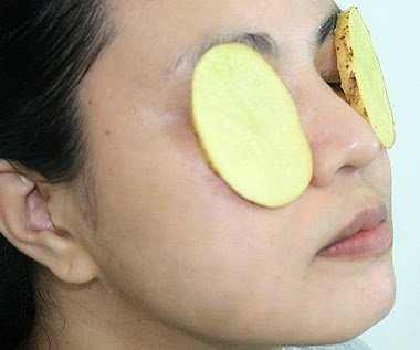 cures-for-dark-circles-under-your-eyes
