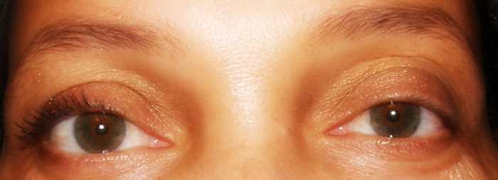 You can clearly see the before and after effect in this image.