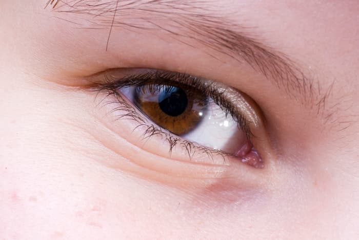 Eye care is key when it comes to preventative skin care!