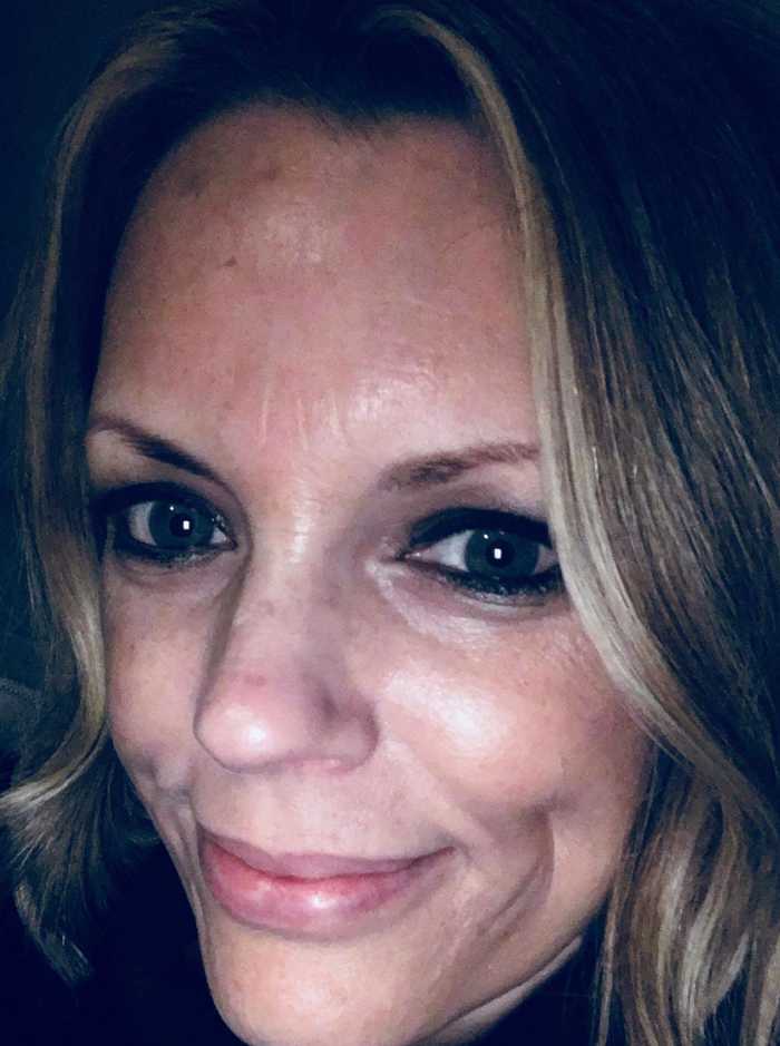 how-to-get-through-the-first-three-months-on-retin-a